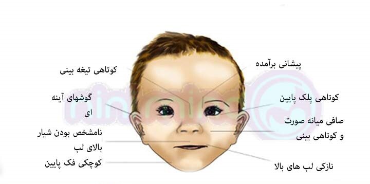 مادارن الکُلی؛ نوزادان قربانی!