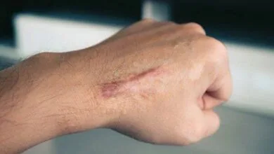 5481605.jpg