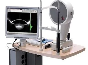 بهره برداری از دستگاه فوق پیشرفته چشم پزشکی در درمانگاه شهید مطهری شیراز