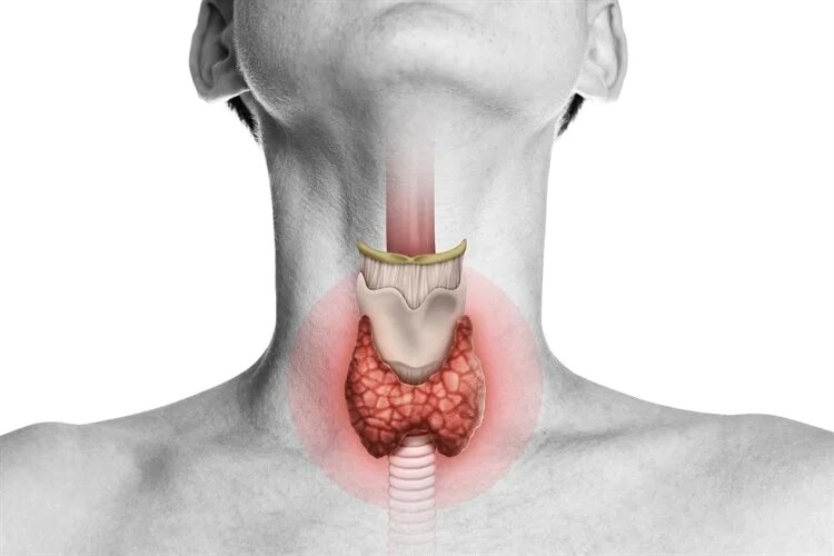 چاقی یا یائسگی عامل پنهان کم‌کاری تیروئید در زنان است؟