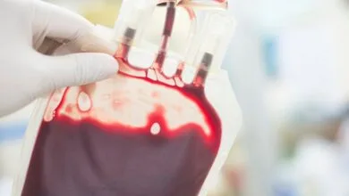 نکاتی درباره تالاسمی ماژور از زبان فوق تخصص بیماریهای خون